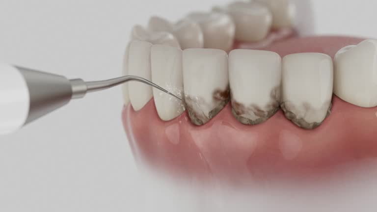 Reliable Wisdom Tooth Removal contractor in Lauderdale County County, TN by Dentist Open Now